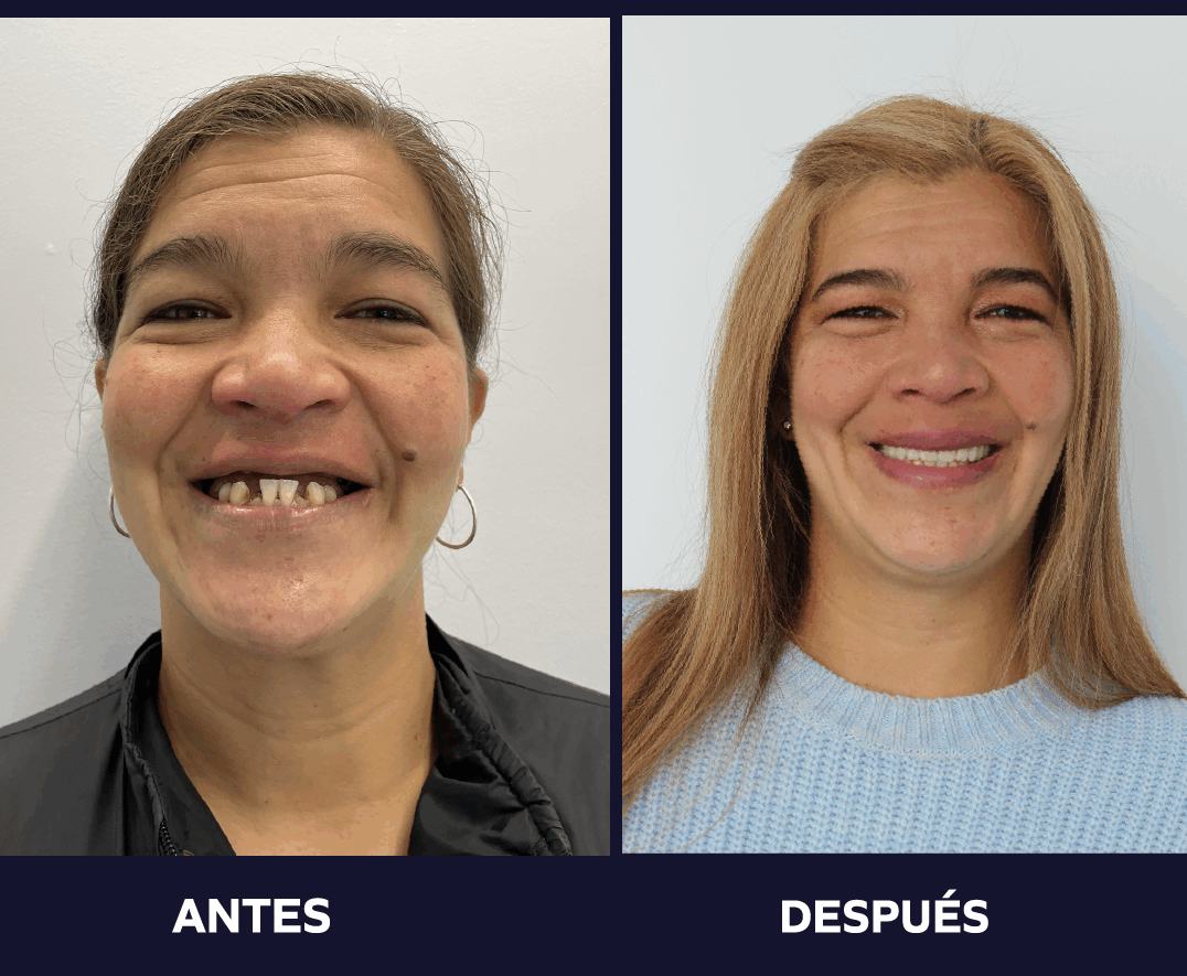 cambiar tu sonrisa cambia tu vida 2022