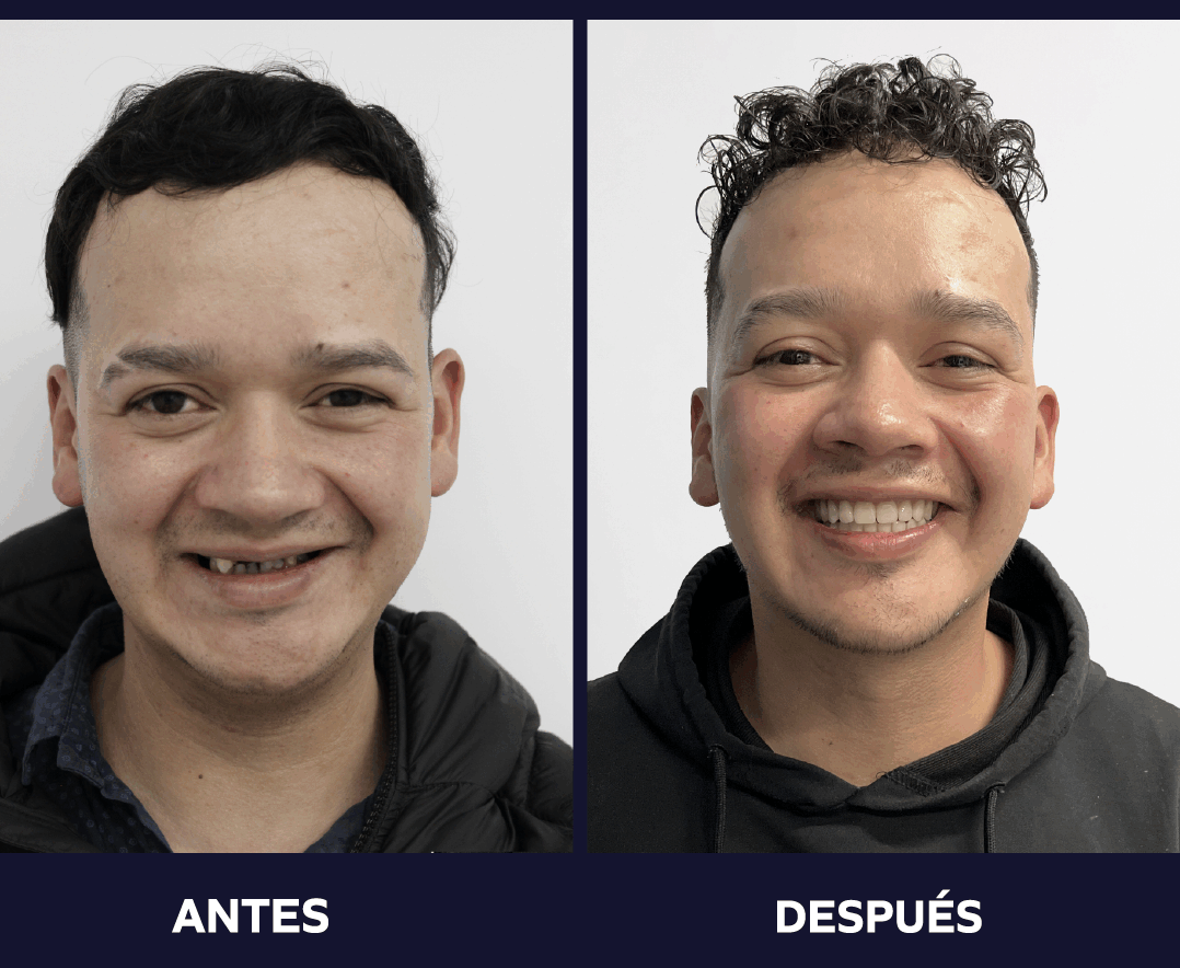 cambiar tu sonrisa cambia tu vida 2023